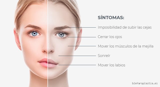 ¿Cómo empieza la parálisis de manera silenciosa y cuáles son las señales tempranas que nadie ve?