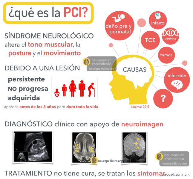 ¿Porque le da parálisis cerebral a un niño? Descubriendo las verdaderas causas ocultas