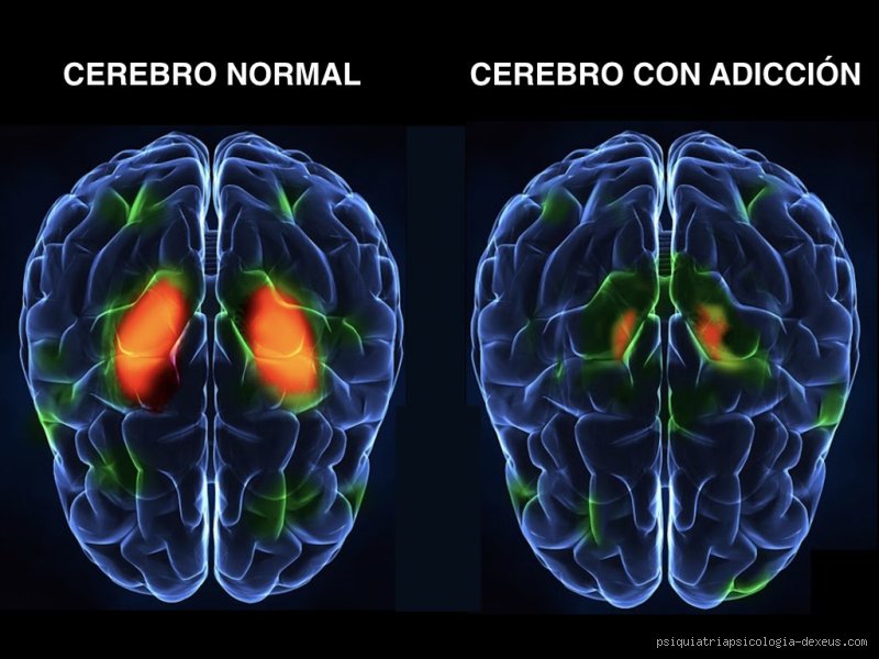 ¿Cómo piensa la mente de un adicto? Desmontando el laberinto neurobiológico de la dopamina y la pérdida de libertad individual