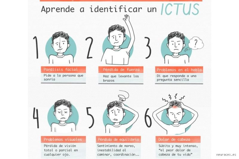 ¿Cuál suele ser el primer síntoma de un ictus?