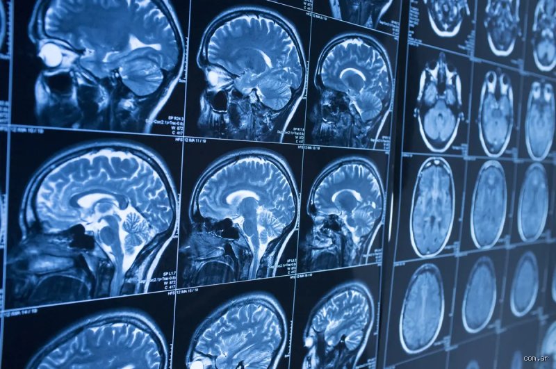 ¿Cuáles son las tres edades clave en las que el cerebro se deteriora drásticamente?