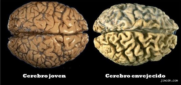 ¿Cuándo empieza el envejecimiento cerebral? La verdad que pocos se atreven a decir