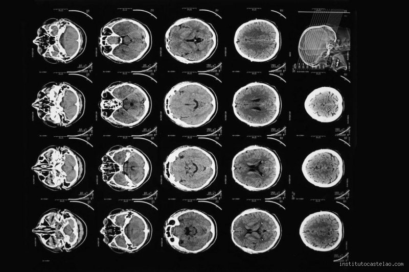 ¿Cuánto tiempo tarda el cerebro en recuperarse de una adicción? El laberinto biológico para recuperar tu mente