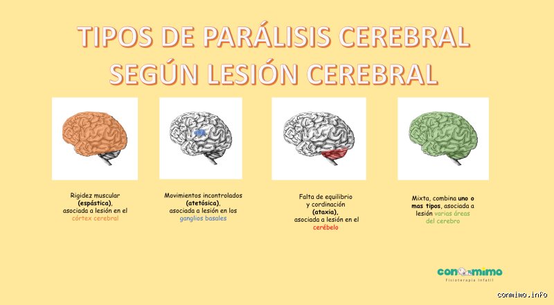 ¿Cuál es la diferencia entre parálisis cerebral y daño cerebral?