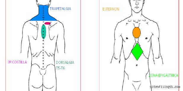 ¿Dónde duele cuando hay problemas de cervicales? El mapa oculto de una tortura moderna que no siempre empieza en el cuello
