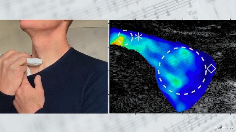 ¿Cantar ayuda a la tiroides? Exploramos la ciencia y los mitos detras de esta vibrante terapia natural