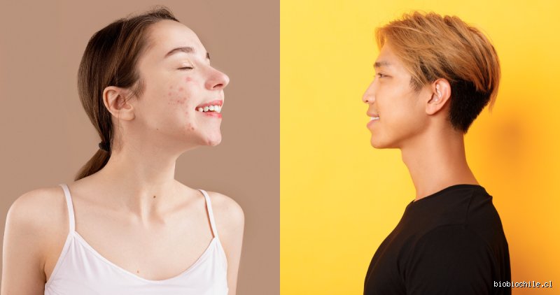 ¿Cara alargada por respirar por la boca? La verdad científica sobre el síndrome de la cara larga y la estética facial