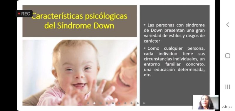 Comprender la realidad profunda y las características psicológicas del síndrome de Down: más allá de los mitos genéticos