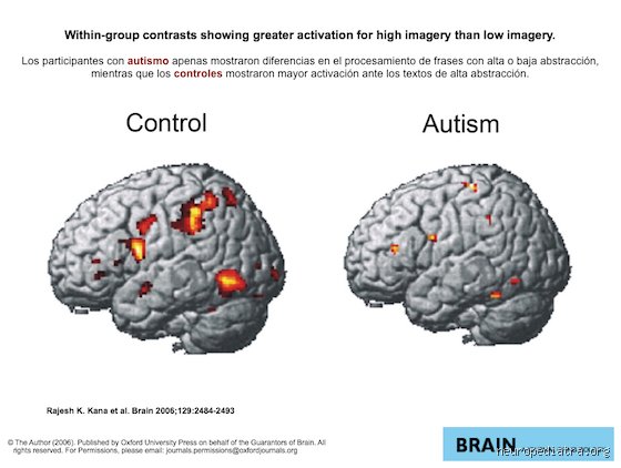 ¿Cómo aprende el cerebro autista? Mas allá de los mitos sobre la hiperfocalización y el procesamiento del detalle