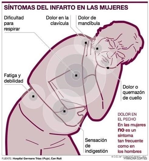 ¿Cómo empieza un infarto en una mujer? Guía detallada sobre los síntomas iniciales que la medicina solía ignorar