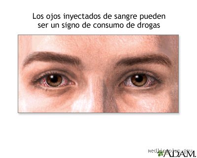 ¿Cómo es la mirada de alguien que consume drogas? Guía experta para descifrar los secretos que revelan los ojos