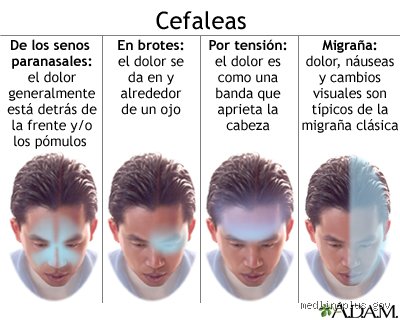 ¿Cómo puedo saber si la presión en mi cabeza se debe a la ansiedad? Claves para distinguir el estrés de un problema físico real