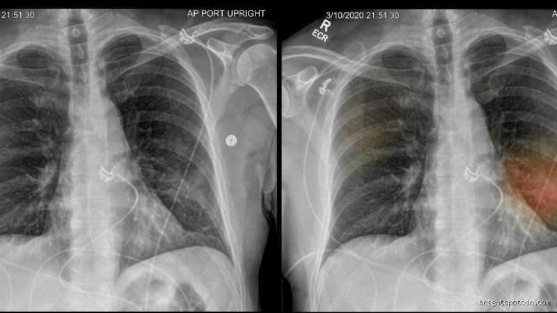 ¿Cómo puedo saber si mis pulmones están recibiendo suficiente oxígeno? Guía técnica para entender tu oxigenación real