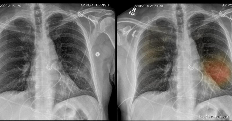 ¿Cómo puedo saber si mis pulmones están sanos? Guía completa para entender tu salud respiratoria sin caer en mitos