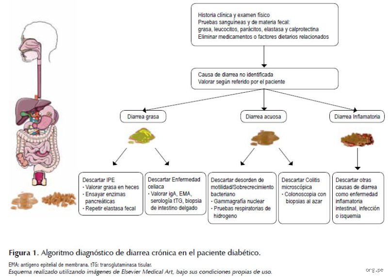 ¿Cómo quitar la diarrea rápido en adultos con diabetes sin comprometer peligrosamente sus niveles de glucosa en sangre?