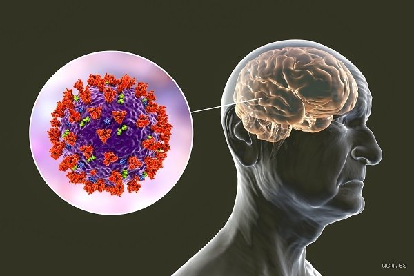 ¿Cómo se llama el virus que ataca al cerebro? Una guía exhaustiva sobre los patógenos que cruzan la barrera hematoencefálica