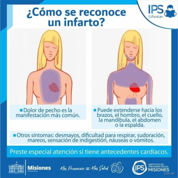 Cómo se reconoce un preinfarto: guía médica detallada para identificar las señales de alarma antes de que sea tarde
