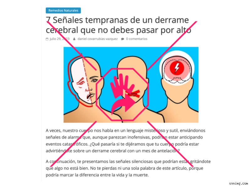 ¿Cómo te avisa el cuerpo antes de un derrame cerebral? Señales silenciosas que salvan vidas