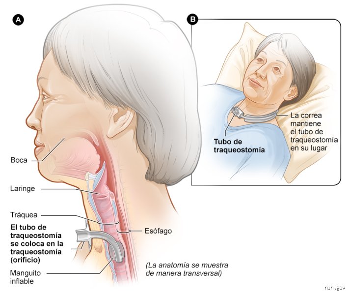 ¿Cuál es el mejor tratamiento para la dificultad respiratoria? Claves médicas para recuperar el aliento de forma inmediata y segura