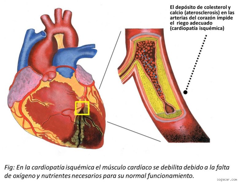¿Cuál es el primer indicio de que el corazón está empezando a fallar? Señales invisibles que ignoramos habitualmente