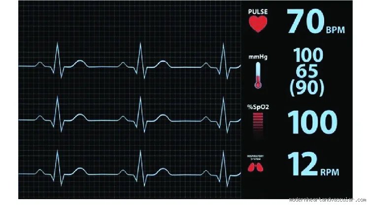 ¿Cuál es el ritmo cardíaco mínimo al que puede llegar su cuerpo de forma segura? La verdad tras las pulsaciones bajas