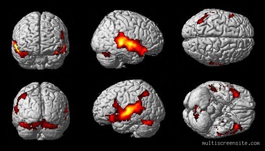 La fragilidad del pensamiento: ¿Cuál es la enfermedad cerebral más grave y por qué nos aterra tanto?