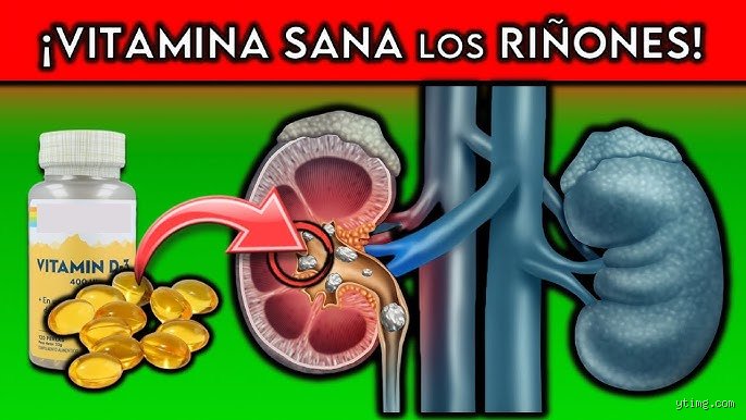 Guía definitiva sobre qué micronutriente protege tus riñones: Descubre cuál es la mejor vitamina para los riñones hoy
