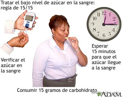 La regla de los 15 minutos para el nivel de azúcar en sangre: la guía definitiva para frenar la hipoglucemia rápido