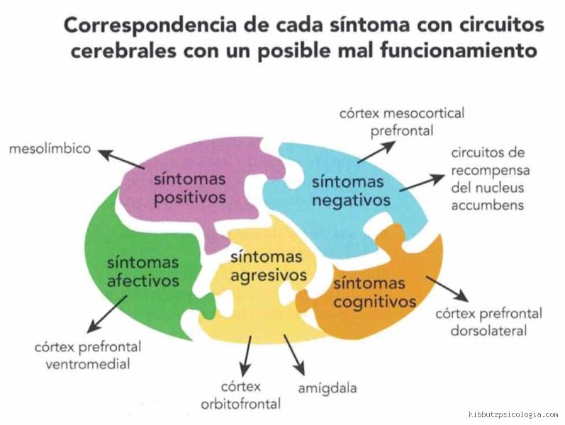Más allá del diagnóstico clínico: ¿Cuál es la tercera regla de la esquizofrenia y por qué rompe los esquemas de la psiquiatría moderna?