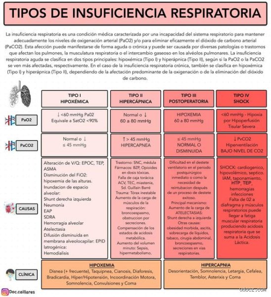 ¿Cuál es un ejemplo de insuficiencia respiratoria tipo 1? El enigma del oxígeno que desaparece sin aviso