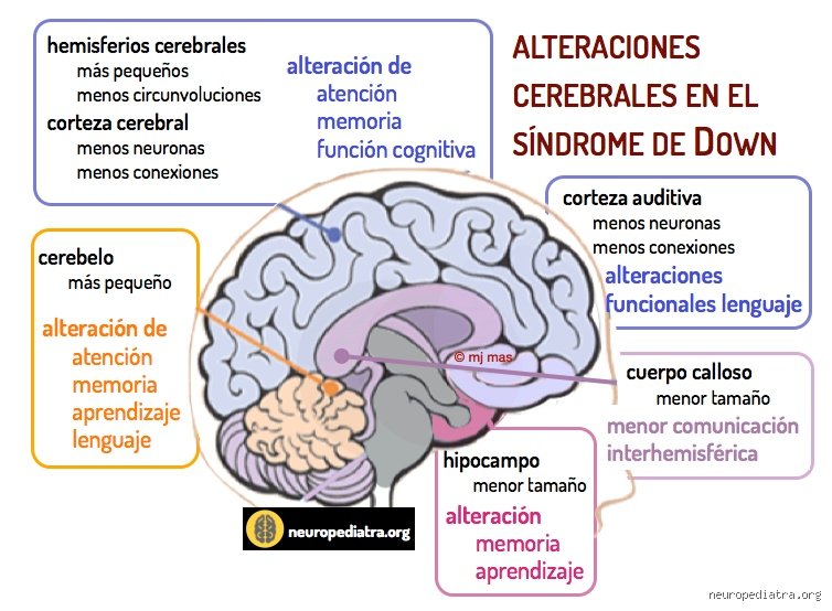 ¿Cuáles son las características cognitivas del síndrome de Down? Un análisis profundo sobre el funcionamiento del cerebro trisómico