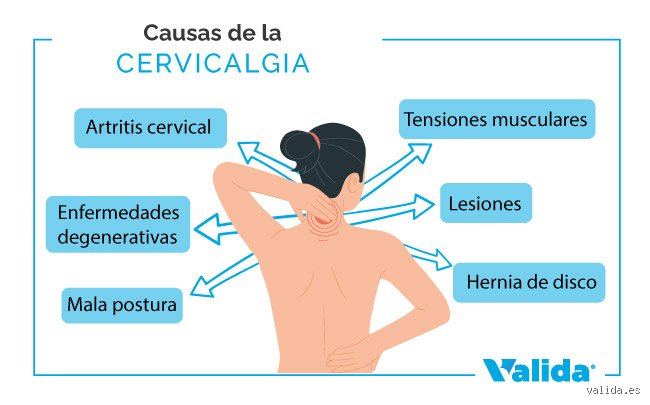 ¿Cuáles son las señales de alerta del dolor cervical que ignoramos hasta que el cuello dice basta?