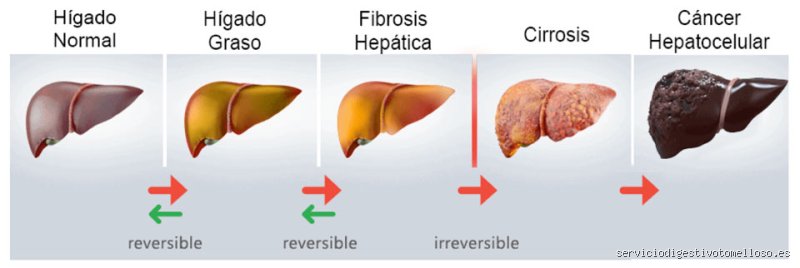 Más allá de la anatomía básica: ¿Cuáles son los 4 tipos de hígado y por qué tu salud depende de entenderlos hoy mismo?