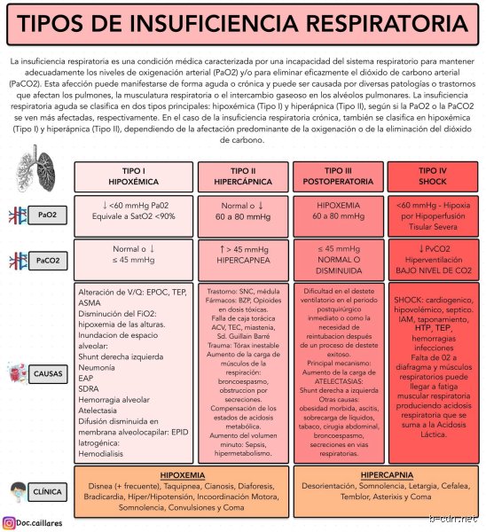 Entender el colapso del sistema: ¿Cuáles son los 4 tipos de insuficiencia respiratoria y por qué tu cuerpo deja de oxigenarse?