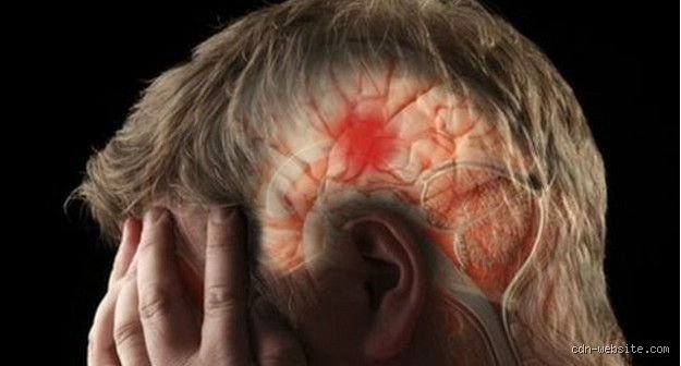 ¿Cuáles son los primeros síntomas de un coágulo de sangre en el cerebro? Guía de detección precoz para salvar vidas