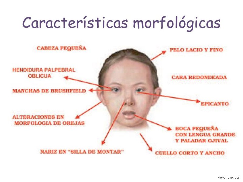 Más allá del diagnóstico médico: descubriendo las verdaderas cualidades de los niños con Síndrome de Down en el siglo XXI