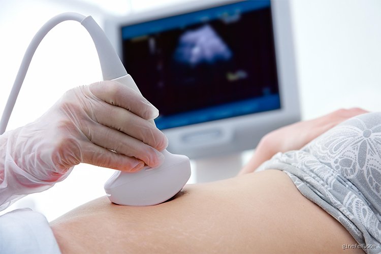 ¿Cuándo es necesario hacer un doppler? Guía definitiva sobre la técnica que vigila tu flujo sanguíneo en tiempo real