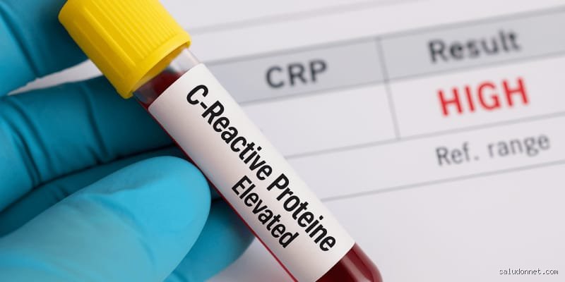 ¿Cuándo es preocupante la proteína C reactiva? Guía experta para entender los niveles de inflamación en tu cuerpo