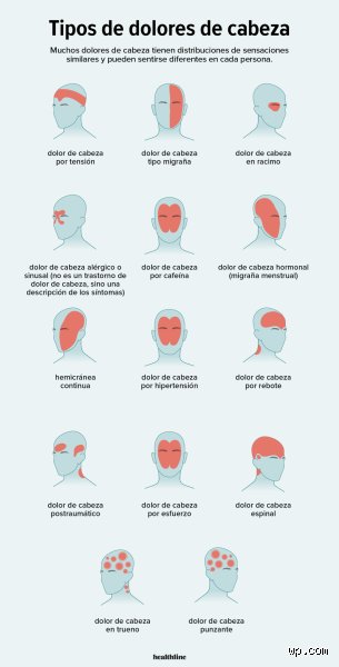 ¿Cuándo hay que preocuparse por la presión en la cabeza? Guía completa para identificar señales de alarma reales