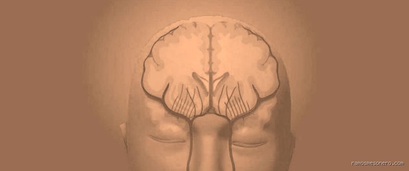 ¿Cuántas veces puede repetirse un accidente cerebrovascular? La cruda realidad sobre la recurrencia y los límites del cerebro