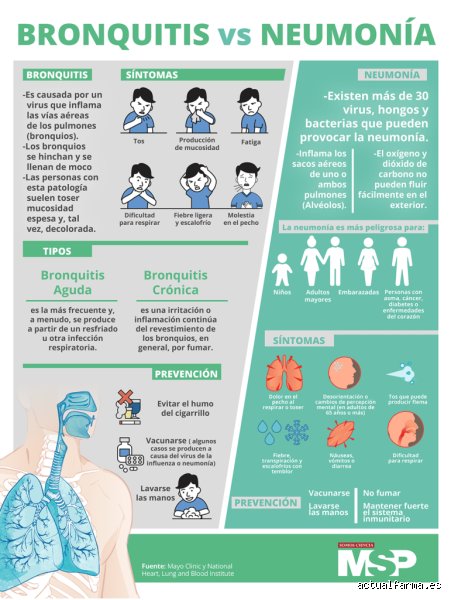 ¿Cuánto tarda en desaparecer la tos por neumonía? Una guía realista sobre los plazos de recuperación pulmonar