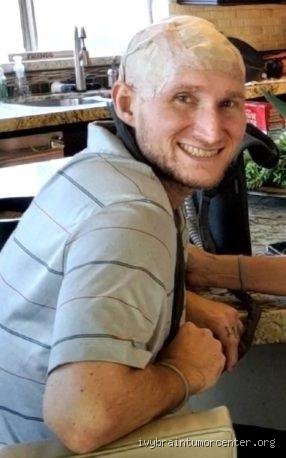 ¿Cuánto tiempo ha vivido una persona con un glioblastoma? Realidades médicas tras las estadísticas de supervivencia