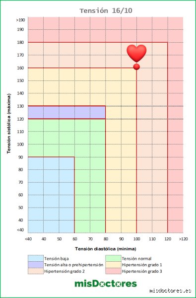¿Debo ir al hospital si mi presión arterial es de 160/100? La guía definitiva frente a una crisis de hipertensión