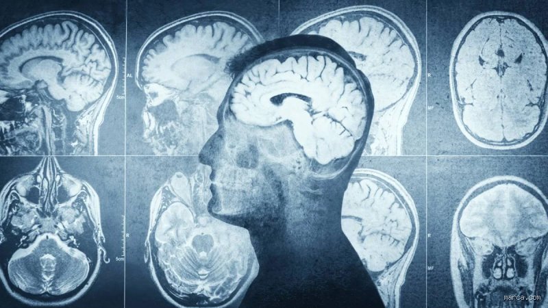 ¿Desaparecen los mini infartos? La verdad sobre las cicatrices silenciosas del corazón que la medicina moderna está redescubriendo