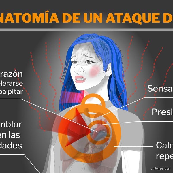 ¿Dónde duele cuando tienes ansiedad? La guía definitiva sobre los síntomas físicos y el mapa del dolor somático