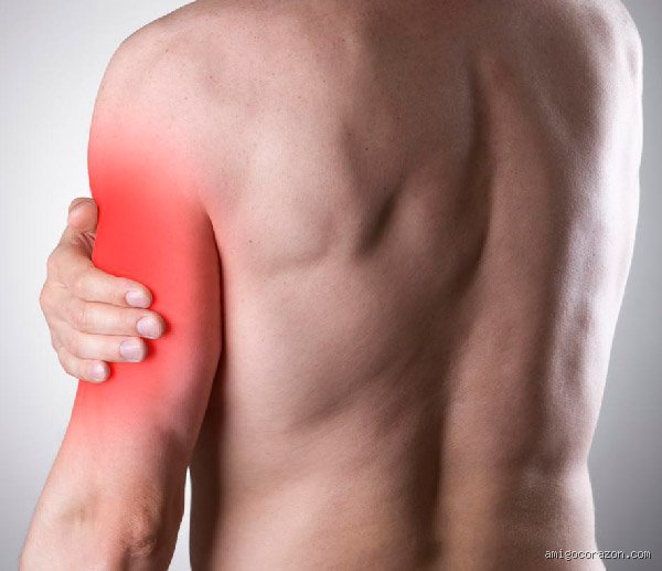 ¿Dónde duele el brazo en un infarto? Descifrando la geografía exacta de una alarma que no siempre es obvia