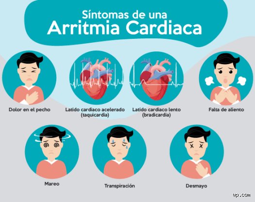 ¿Dónde te duele cuando tienes arritmia y por qué el pecho no es el único protagonista de esta historia?
