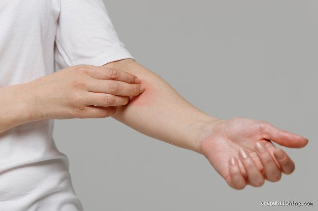¿Dónde te pica cuando tienes diabetes? Las zonas críticas y el lenguaje oculto de tu piel bajo el azúcar