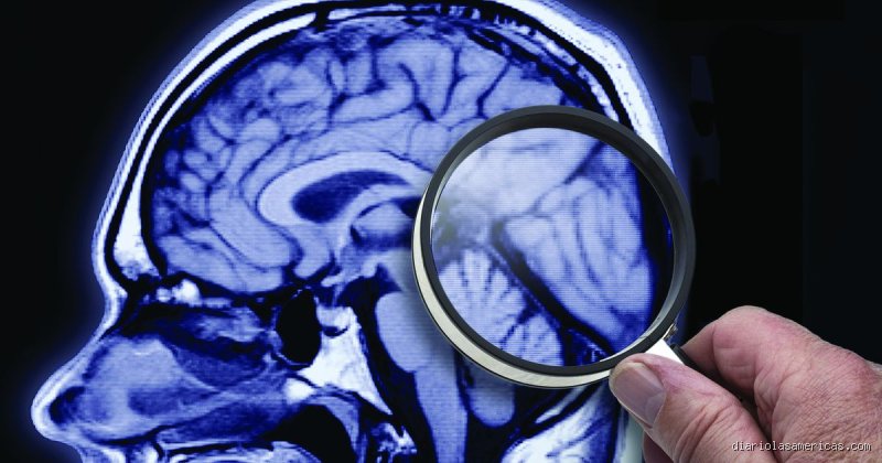 ¿El daño cerebral permanente implica la muerte? Descifrando la delgada línea entre la biología y la consciencia humana