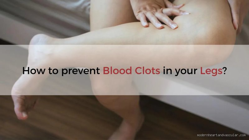¿Realmente elevar las piernas puede provocar coágulos de sangre o es el mito médico más extendido del siglo?
